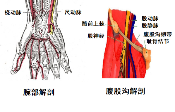 股动脉穿刺