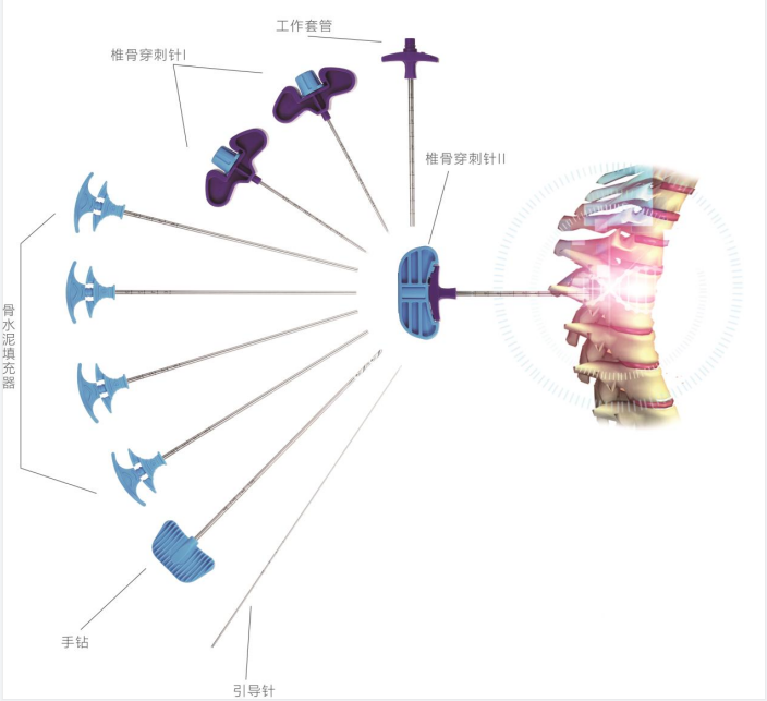 椎体成形扩张器简介